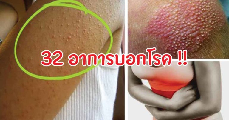 ลองสังเกตุตัวเองเลยนะ 32 อาการบอกโรคที่ไม่ควรมองข้ามอย่างเด็ดขาด