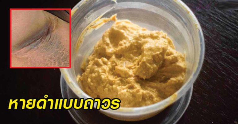 แนะนำเลย!! 9 สูตรแก้ขาหนีบดำ..ให้หายดำแบบถาวร