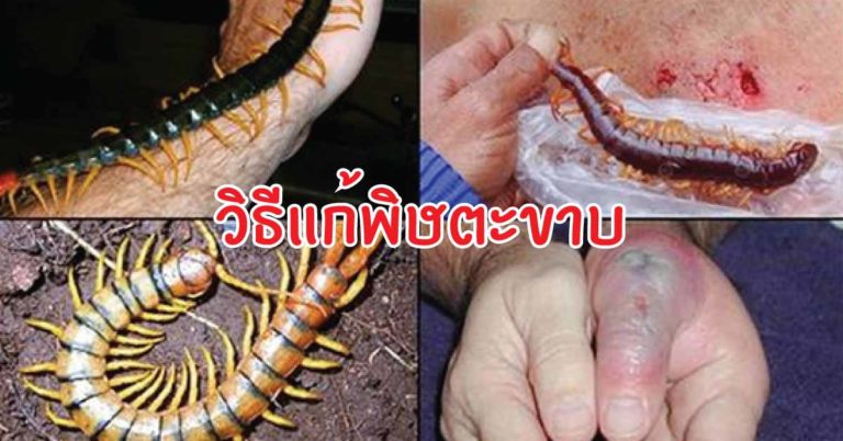 วิธีปฐมพยาบาลเมื่อโดน ตะขาบกัด ได้ผลดีจริง หายเร็วด้วย แชร์เก็บไว้เลย…เผื่อได้ใช้