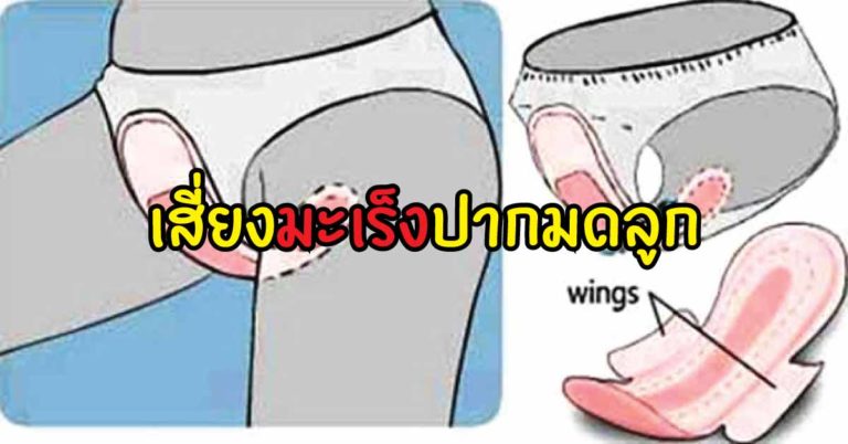 4 คำเตือน ก่อนใช้ ผ้าอนามัย ลดโอกาสการเป็น มะเร็งปากมดลูก