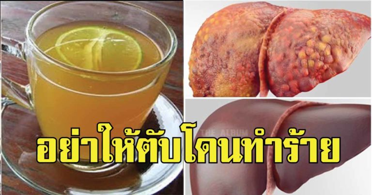 แนะนำ วิธีทำความสะอาดตับ กำจัดสารพิษออกจากตับอย่างได้ผล