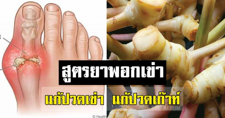 สูตรยาพอกเข่า แก้ปวดเข่า แก้ปวดเก๊าท์ ด้วยสมุนไพรเก่าแก่ที่ได้ผลดี