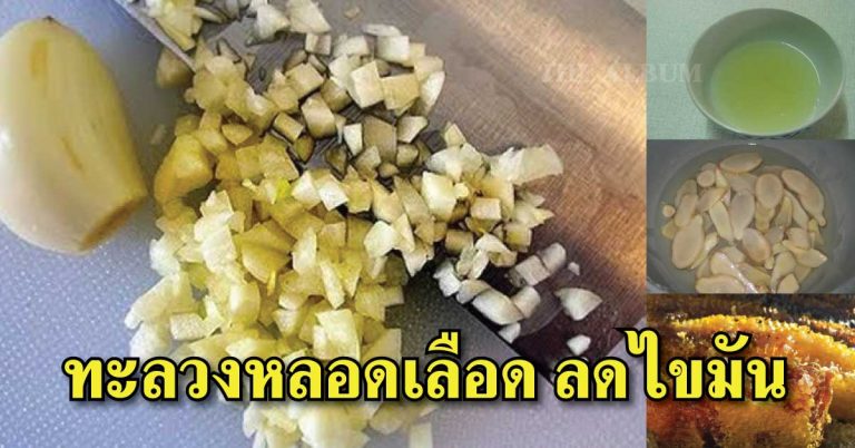 สูตรน้ำสมุนไพร ลดไขมัน ทะลวงหลอดเลือด หลอดเลือดตีบตัน รักษาได้