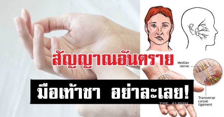 ฝากเตือน! สัญญาณอันตรายจาก “มือเท้าชา” อย่าคิดว่าไม่สำคัญ