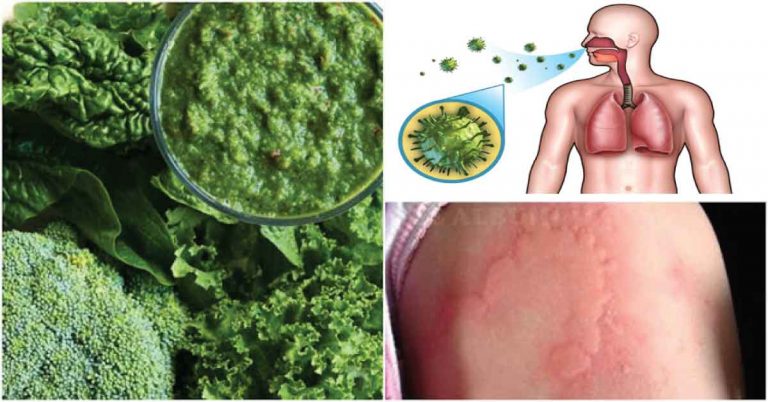 10 อาหารช่วยต้านโรคภัย ต้านภูมิแพ้ แชร์เก็บไว้เลย