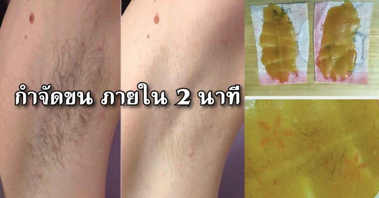 3 วิธีกำจัดขนรักแร้ ให้เนียนขาว ภายใน 2 นาที ทำง่าย ประหยัดเวลาด้วย!!