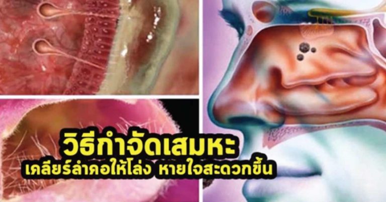 12 วิธีกำจัดเสมหะ ในลำคอ เคลียร์ทางเดินหายใจให้โล่งขึ้น ทำแล้วดีมากๆ