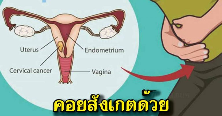 ผู้หญิงต้องอ่าน 7 สัญญาณ “โรคมะเร็งปากมดลูก” ที่ต้องคอยสังเกตอยู่บ่อยๆ