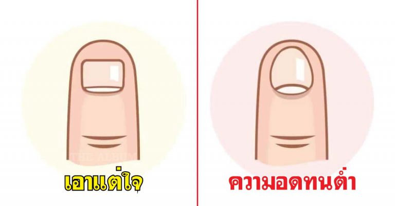 6 ลักษณะเล็บมือ จะบ่งบอกนิสัยในตัวคุณ หงายเล็บมาดูกัน