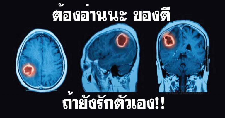 ต้องอ่านนะครับ ของดี ถ้ายังรักตัวเอง!!