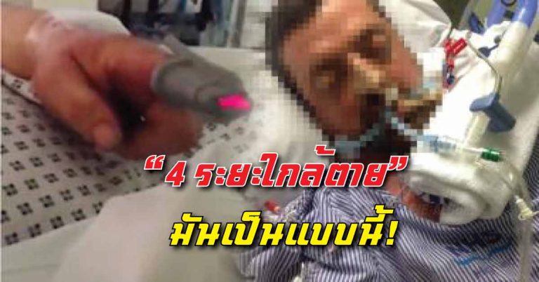 “4 ระยะก่อนสิ้นชีพ” มันมีความรู้สึกแบบนี้!