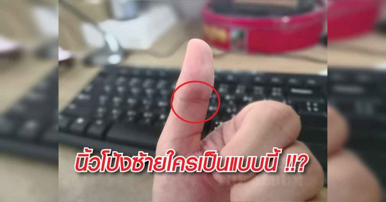 หัวนิ้วมือด้านซ้ายใครเป็นแบบนี้ เชื่อกันว่ามีพลังงานพิเศษ