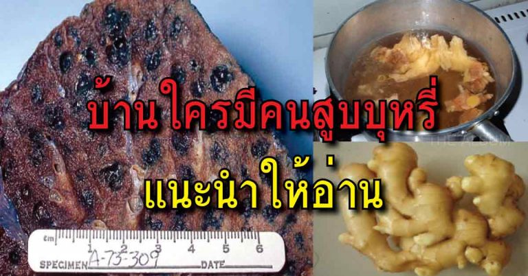 บอกบุญ..แค่นำขิงมาต้มกับของ 3 อย่างนี้ กินวันละ 2 ครั้ง เช้าเย็น ช่วยขจัดสารนิโคตินที่สะสมอยู่ในปอด บ้านใครมีคนสูบบุหรี่แนะนำให้อ่าน