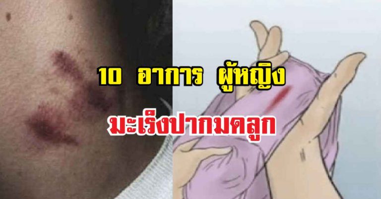 10 อาการ ผู้หญิงที่จะเป็น “มะเร็งปากมดลูก” รู้ไว้ก่อนสายเกินแก้