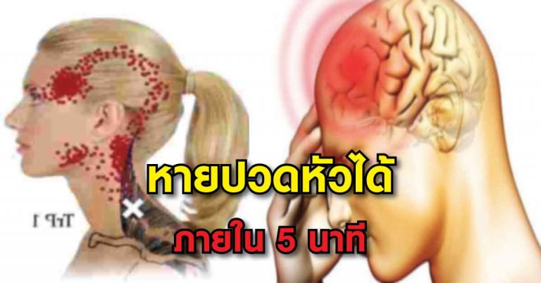 เคล็ดลับจากแพทย์แผนอินเดียโบราณ เผยวิธีแก้อาการปวดหัวได้ด้วยตัวเอง ภายใน 5 นาที