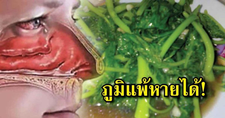 โรคภูมิแพ้รักษาให้หายได้ ด้วยอาหาร 4 ประเภทต่อไปนี้