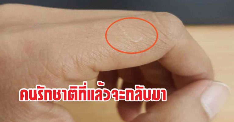 แผลเป็นนิ้วชี้ข้างซ้าย บ่งบอกว่าคนรักเก่าจากชาติที่แล้วจะกลับมา