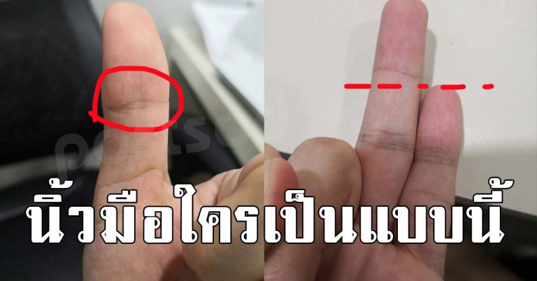 ยกขึ้นมอง นิ้วหัวเเม่มือด้านซ้าย ใครมีวง มีเส้น ว่ากันว่ามีพลังงานพิเศษ