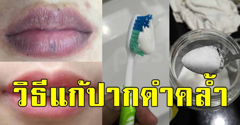 ขอบปากดำ สีคล้ำ เปลี่ยนเป็นปากชมพูได้ 7 วิธีเปลี่ยนแบบธรรมชาติ