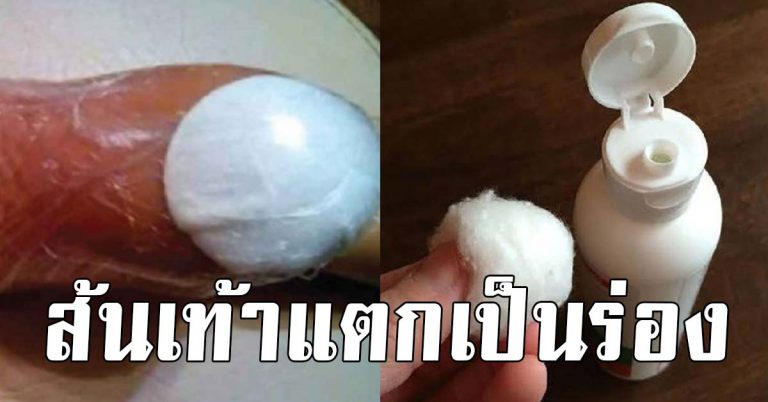 เผยเคล็ดลับ แก้ส้นเท้าเเตกเป็นร่อง ไม่ง้อครีมแพงให้เปลือง ไม่ถึง 80 บาท