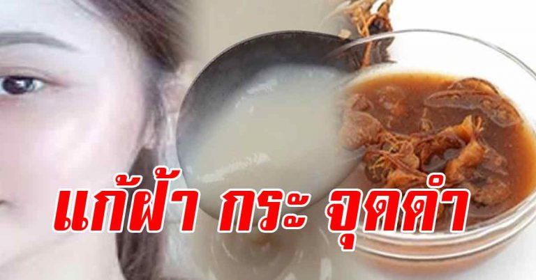 ลบฝ้า 3 สูตร จุดดำ รอยคล้ำ เผยหน้าใสขาวเร็ว