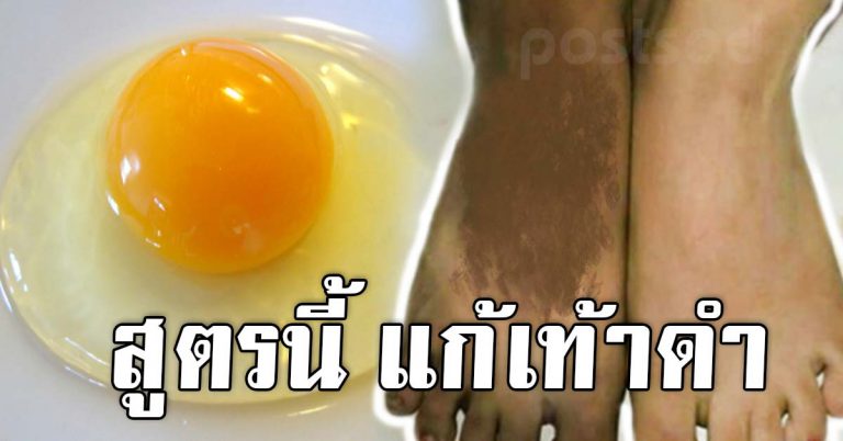 เท้าดำ มือดำ เเก้ได้ 10 สูตรบำรุง ขัดผิวง่าย เปลี่ยนเท้าดำให้ขาวนุ่ม