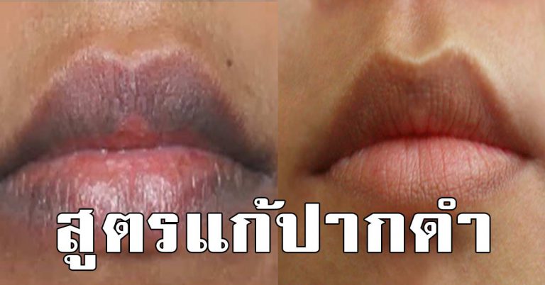 ปากดำแก้ได้ 10 เคล็ดลับสครับปากชมพูแบบธรรมชาติ ทำได้ง่าย