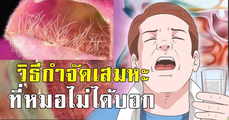 10 วิธีจัดการเสมหะ สีเขียว ในลำคอ เคลียร์ทางเดินหายใจให้โล่ง ทำแล้วดีมาก