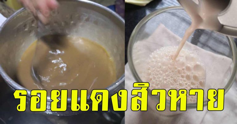 เผยวิธี รอยสิว ลดสิวอุดตัน ให้หายไป มะขามเปียก ผสมมะนาว