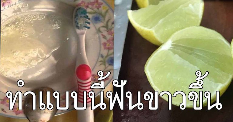 สูตรฟันขาว 5 เทคนิคฟันคุณกลับมาขาววิ้งได้ ทำตามได้เลย