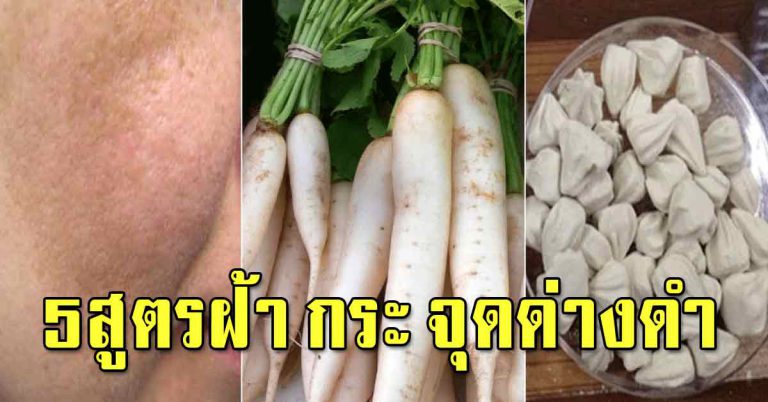 วิธีแก้ฝ้า กระ ระยะยาว 6 สูตร จางลงอย่างเห็นได้ชัด