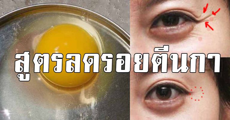 สอนทำสูตรลับ ช่วยลดรอยใต้ตา ริ้วตา ริ้วรอยย่น แบบได้ผลดีเวอร์