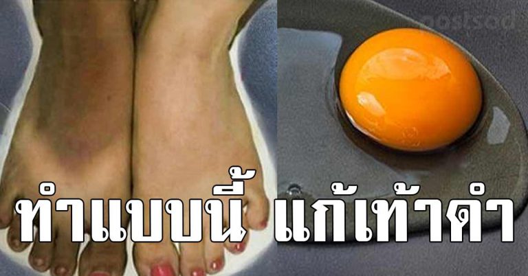 10 วิธี แก้เท้าดำ มือดำให้ขาว ตาตุ่มแห้งกร้าน ให้กลับมาขาวเนียนนุ่ม