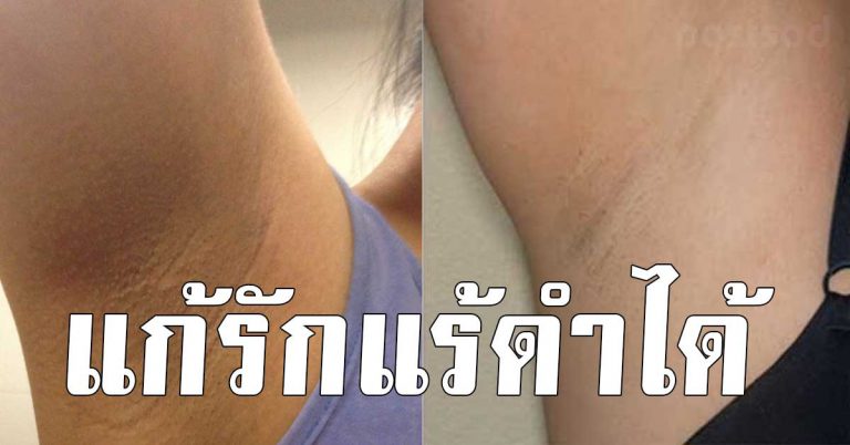 6 สูตร วาสลีน แก้ผิวหน้าคล้ำ รักแร้ดำ ให้ผิวเนียนละเอียด ขาวไว