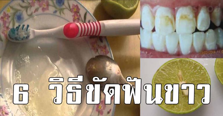 ฟันเหลือง ทำไง เคล็ดลับขัด ฟันขาว 6 สูตร แบบง่ายๆ ดูดีขึ้น