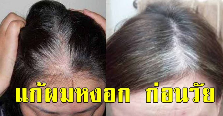 10 วิธีแก้เส้นผมขาว โคนขาว พิชิตผมขาวแบบง่ายๆ ที่คุณควรรู้