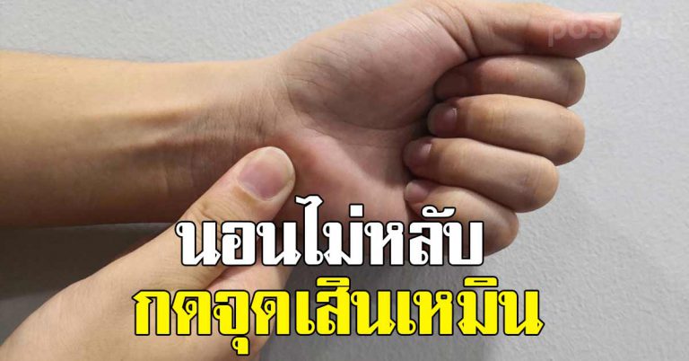 วิธีกดมือแก้นอนไม่หลับ ลืมง่าย โกรธง่าย แถมช่วยให้ร่างกายดีขึ้น