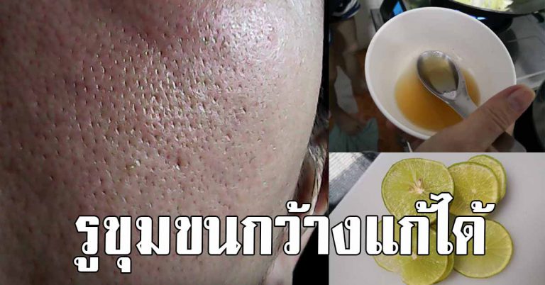 รูขุมขนกว้าง หน้ามัน แนะให้ทำ 10 วิธีง่ายๆ เหมาะกับคนอายุ 40