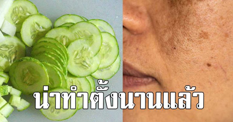 ป้าใช้แตงกวา 3 สูตร ลบกระให้เกลี้ยงหน้า จุดด่างดำ สิวอุดตัน