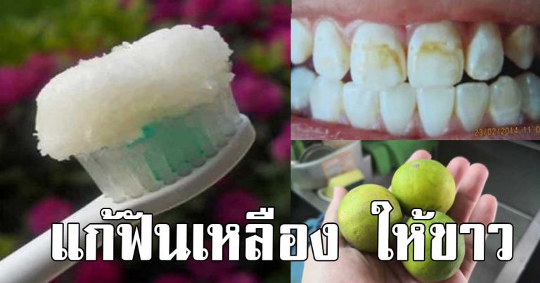 น่าทำนานแล้ว 6 วิธีทำให้ฟันขาว ด้วยมะนาว ดูดีขึ้นใน 2 สัปดาห์