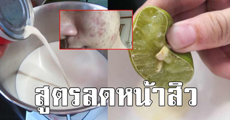 เเม่ให้ทำ 7 วิธีช่วยลดรอยดำ ที่หน้า รอยกระหาย ฝ้าจาง เซฟไว้ทำ