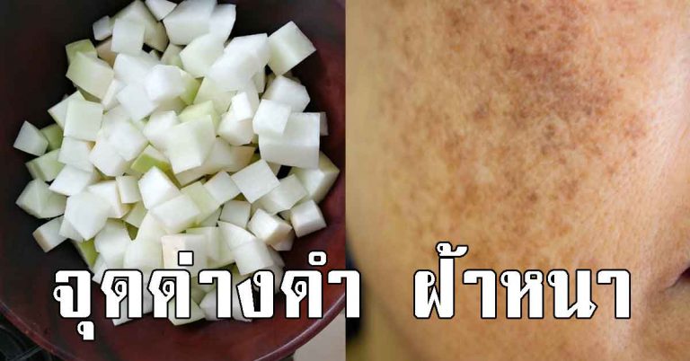 เคล็ดลับ 4 สูตรผิวดี ลบกระ จุดด่างดำ วัย 30 ยิ่งต้องทำ