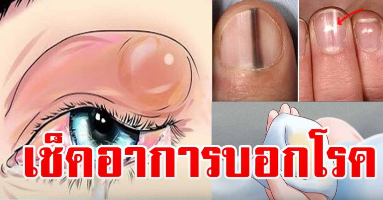 สังเกตให้ไว 32 อาการ บอกว่าคุณกำลังเป็นอยู่ ให้รีบทำเลย