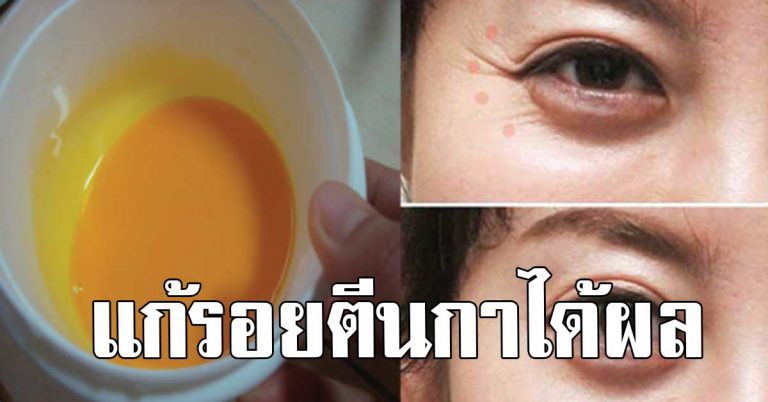 ป้าสอนทำ ลดรอยตีนกา ริ้วรอยย่น ผลลัพธ์ดีเวอร์ ทำสัปดาห์ละ 2 ครั้ง