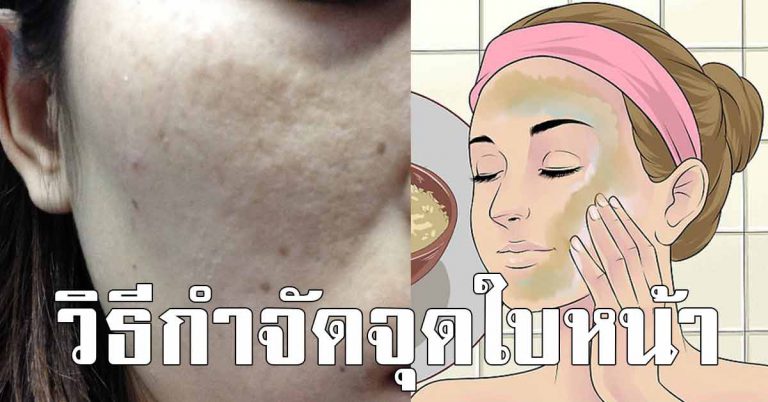 วิธีลบจุดดำๆ บนใบหน้า ผิวหน้าใสขาวขึ้นในเวลาเพียง 3 คืน