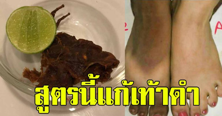 เท้าดำ เเก้ได้ 10 สูตรบำรุง ขัดผิว เปลี่ยนเท้าดำให้ขาวนุ่ม