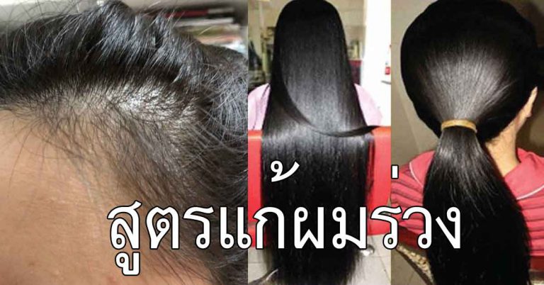 เส้นผมหงอก ร่วง ให้กลับเงาดำ เส้นผมหนาขึ้น