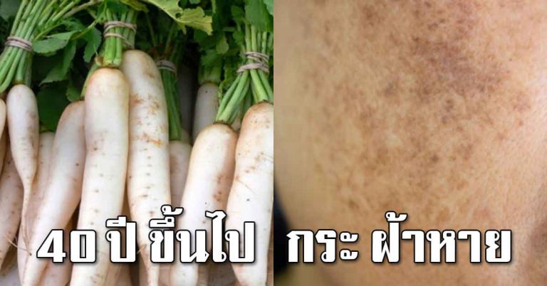 ทำแล้วใสขึ้น ลบกระ รอยฝ้าบนใบหน้า 40ปีขึ้นไปน่าทำ