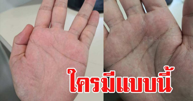 ยกมือขึ้น กากบาทกลางฝ่ามือ ใครมีเส้นนี่อยู่บ้าง