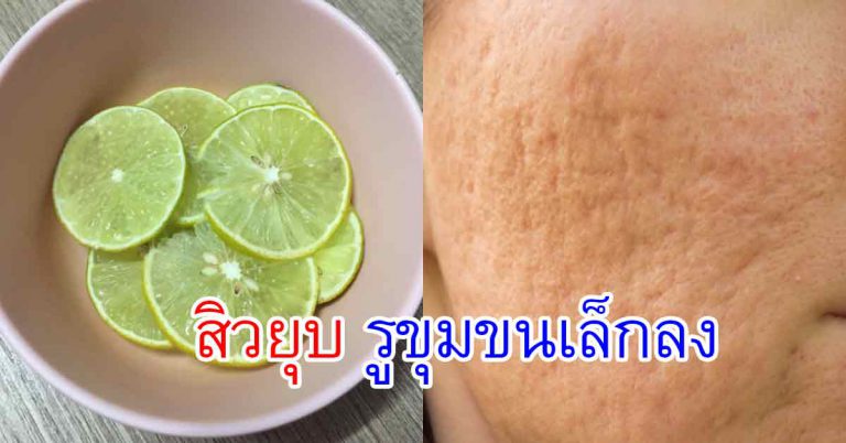 7สูตร รูขุมขนเล็กลง ผิวอ่อนนุ่ม เรียบเนียน ไม่ใช้ครีมแพงๆ